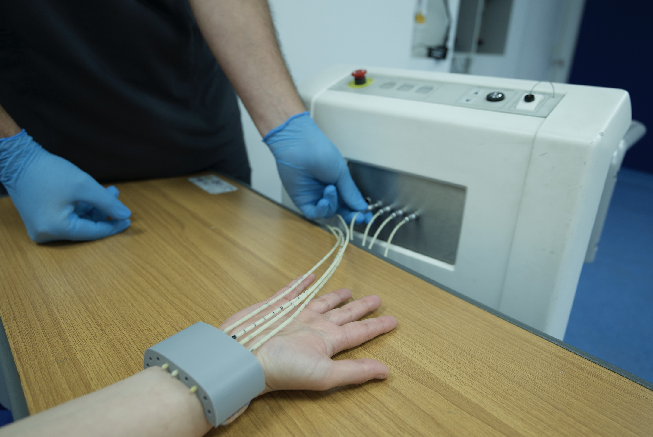 Radioterapia interna (braquiterapia)